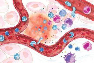 Efectul Boswellia asupra zonelor inflamate ale corpului