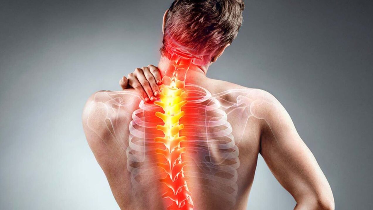 simptome de osteocondroză spinală
